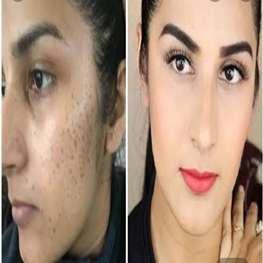 herbal-pure-product-9